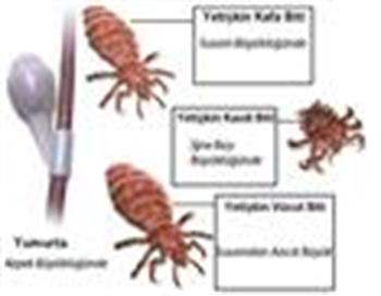 Bitten Kurtulma Yolları Bitten Kurtulma Yolları